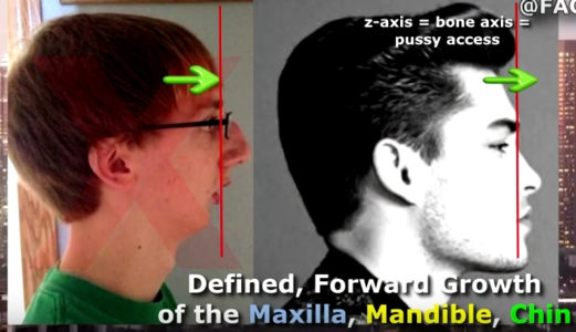 Chin maxilla.png